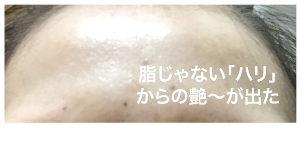 米肌の澄肌美白お試しセットを使ったらおでこがツヤでた写真